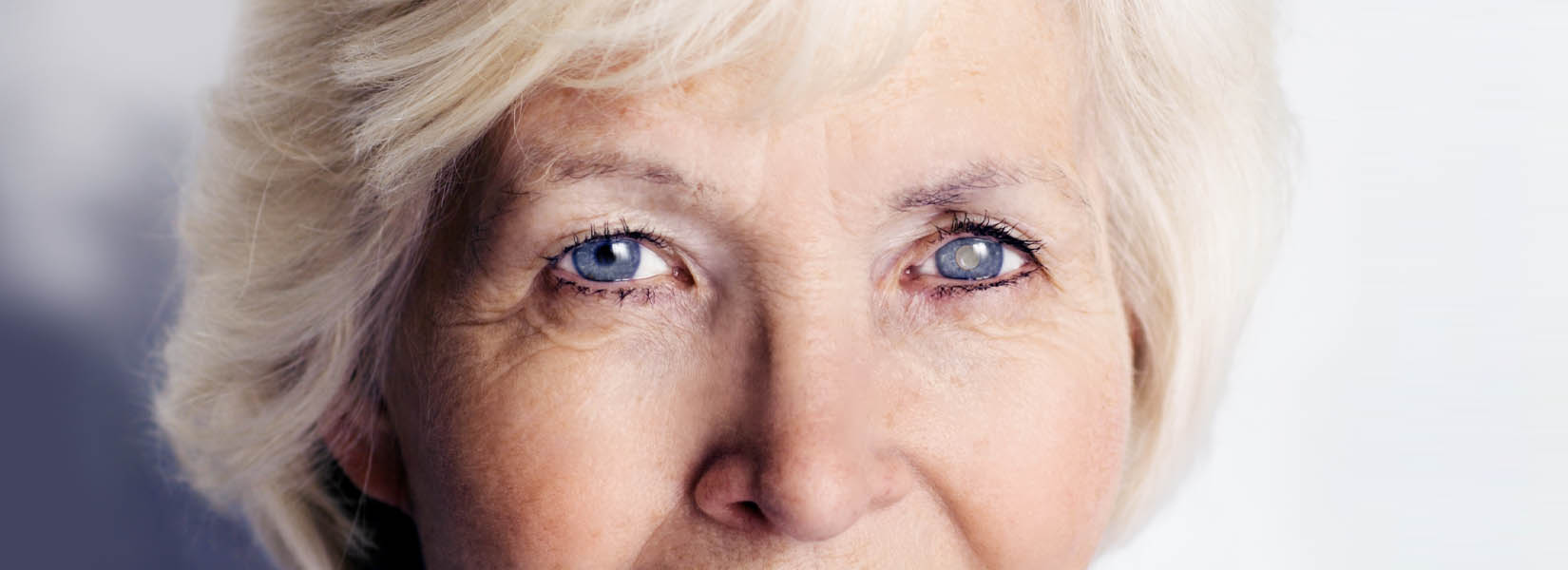 Cataract Surgery in Clyde